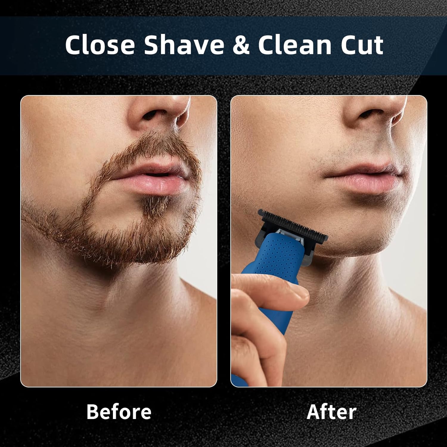 Beard Trimmer for Men, Zero Ga - Men'S Grooming Guide のレビューと価格